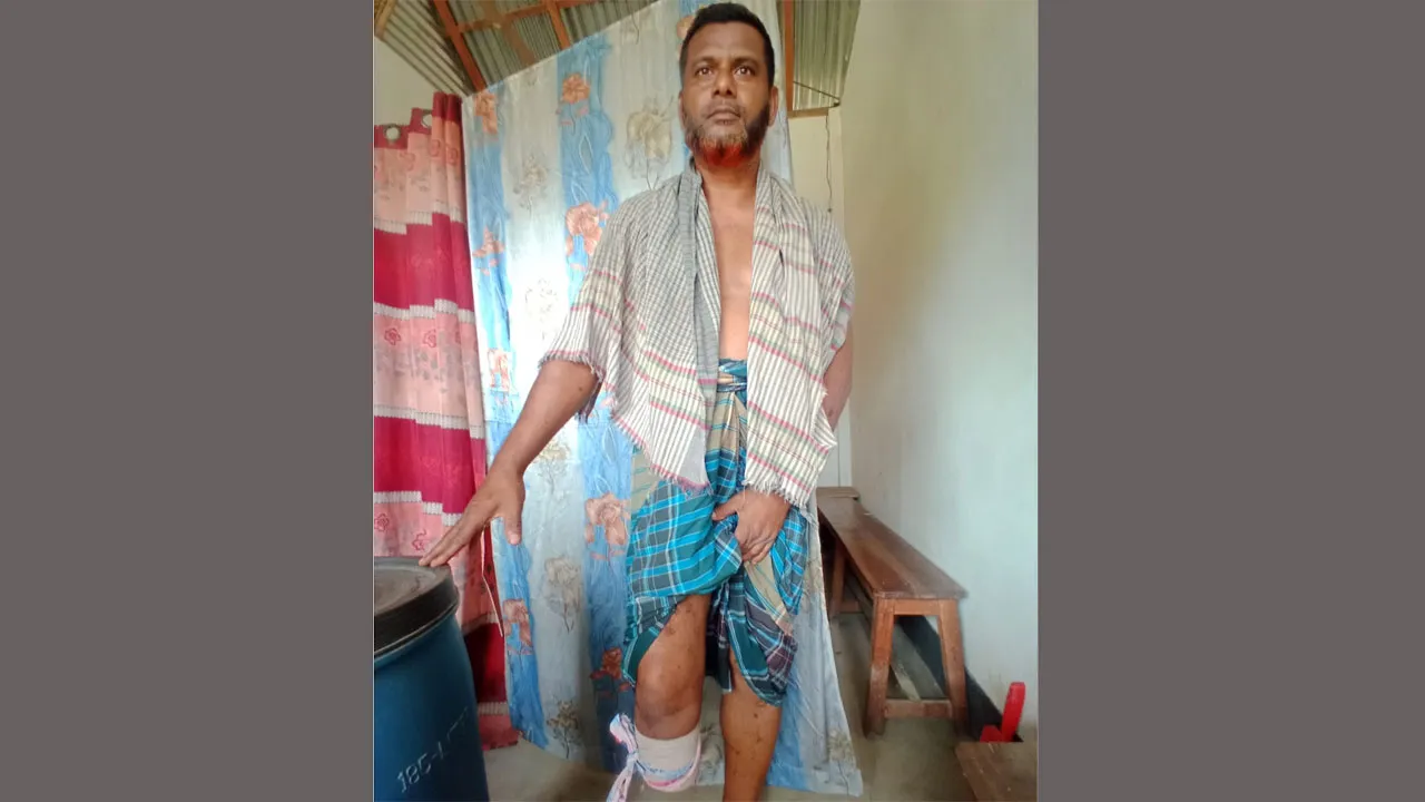 সরকারের কাছে আর্থিক সহায়তা চান পঙ্গু রানা মিয়া