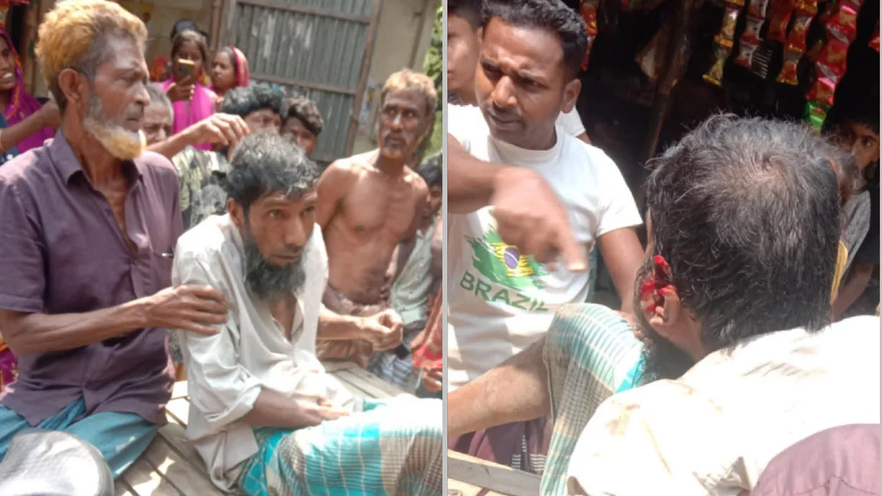 ভিক্ষুকের কাছে টাকা দাবি মাদকসেবীর, না দেয়ায় পিটিয়ে রক্তাক্ত