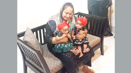 আলাদা হলো জোড়া লাগানো শিশু জুহি-রুহি
