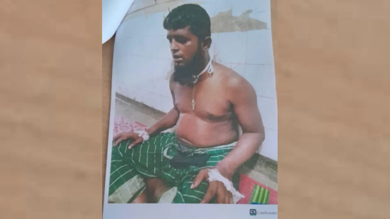 গলায় গুলি নিয়ে এখনো যন্ত্রণায় কাতরাচ্ছেন জুলাইযোদ্ধা সাইফুল