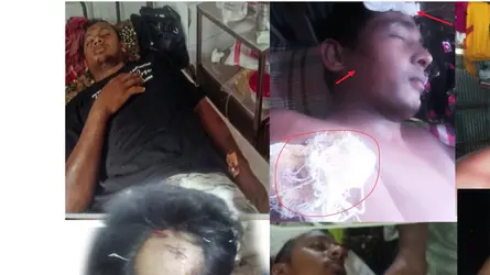 এমপির গাড়িতে হামলা-ভাঙচুরের ঘটনায় মামলা, গ্রেফতার ৯