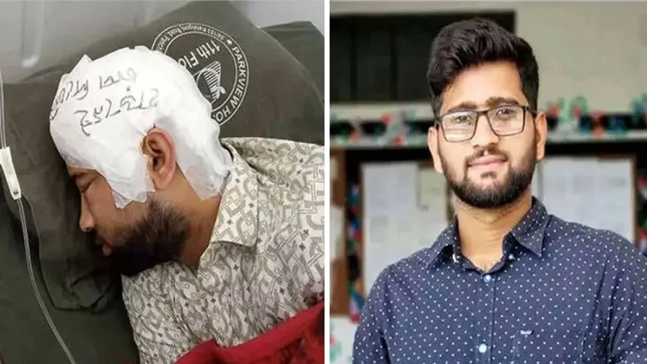 সংঘর্ষে আহত চবি শিক্ষার্থী মামুনের মাথার খুলি ২ মাস পর প্রতিস্থাপন