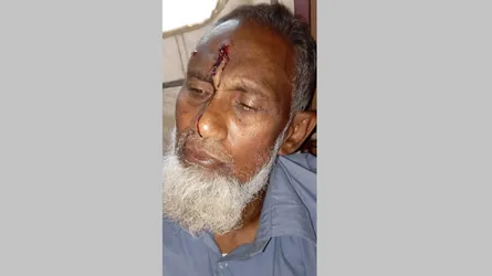 থানায় অভিযোগ দেয়ায় চাচা-চাচাতো ভাইয়ের ওপর হামলা