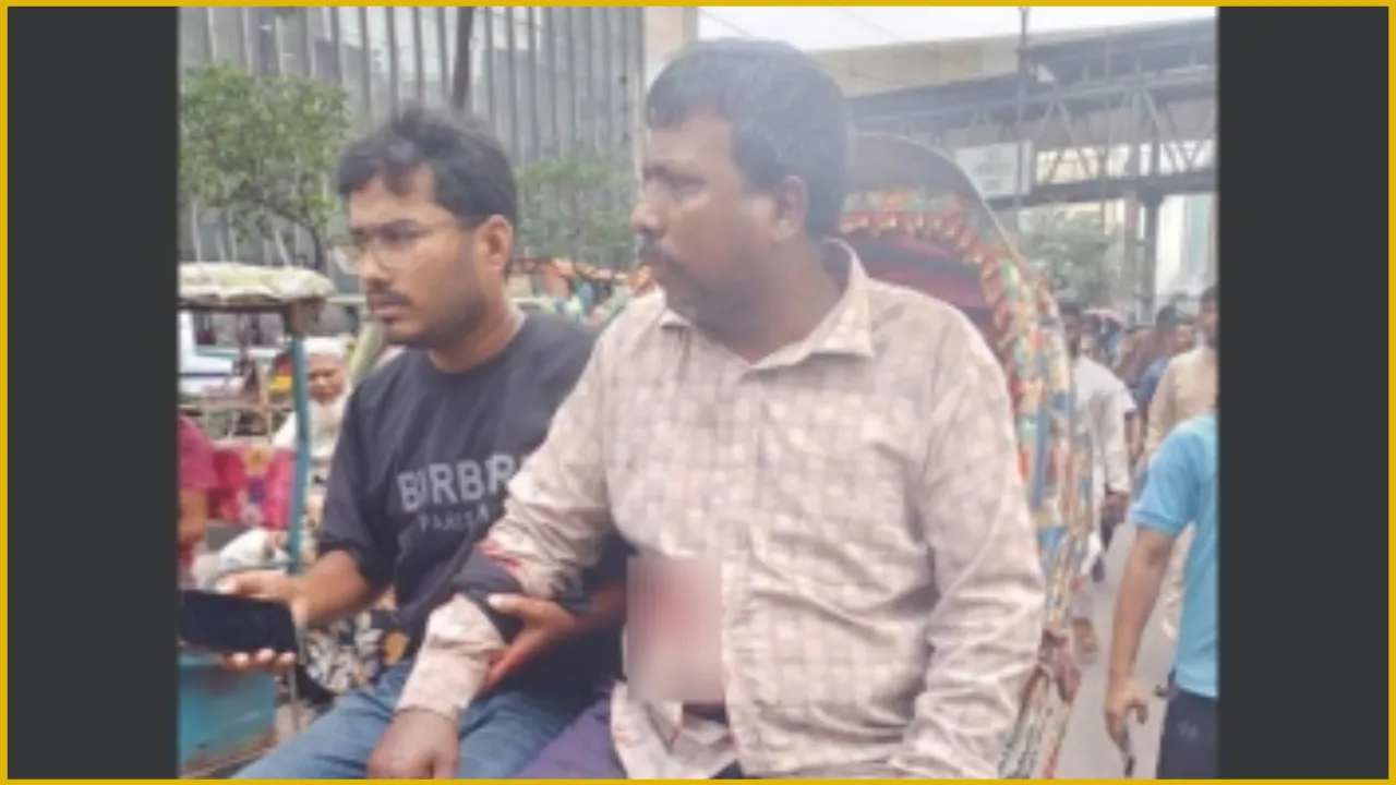 মতিঝিলে প্রকাশ্যে ব্যবসায়ীকে গুলি করে ১৭ হাজার ডলার ছিনতাই