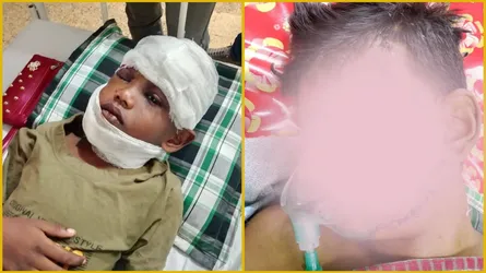 সড়ক দুর্ঘটনায় আহত হয়ে চিকিৎসাধীন এতিম ২ ভাই, প্রয়োজন অর্থ সহায়তা