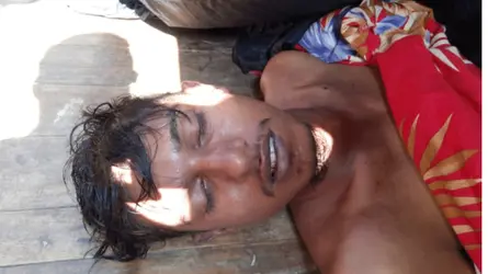 নবাবগঞ্জে বজ্রপাতে যুবকের মৃত্যু