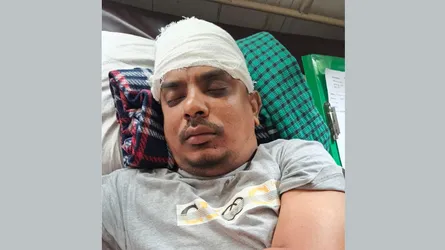 আড়াইহাজারে বসতবাড়িতে ডাকাতি, ২ ভাই আহত