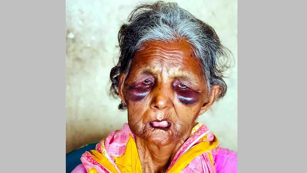 পরিচয় মিলেছে রায়পুরায় ছিনতাইকারীদের হামলায় নিহত পরিচ্ছন্নতাকর্মী ববির
