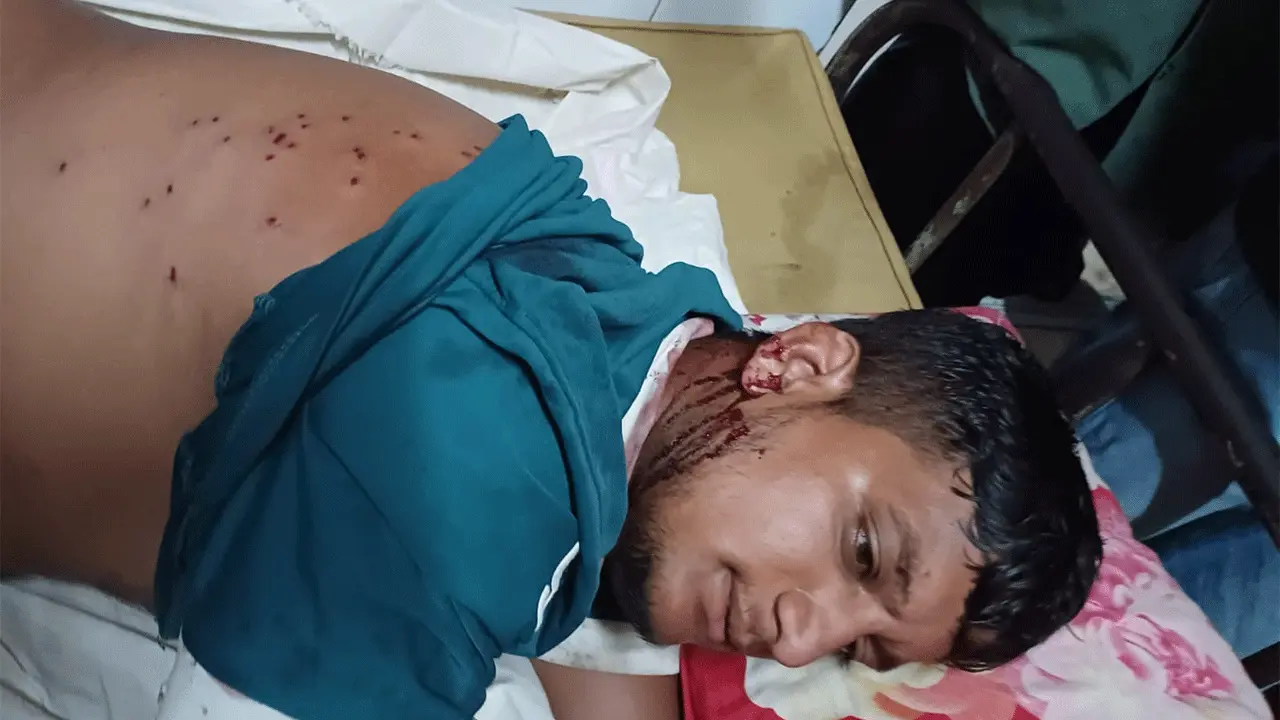 নোয়াখালীতে গায়ে হলুদে যাওয়ার পথে গুলিবিদ্ধ ৫