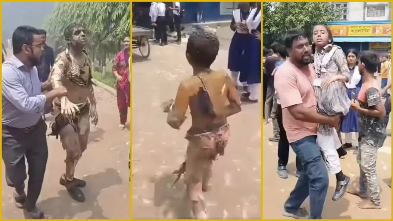 বিমান বিধ্বস্ত : ঘটনাস্থল থেকে পোড়া শরীর নিয়ে বের হচ্ছেন অনেকে