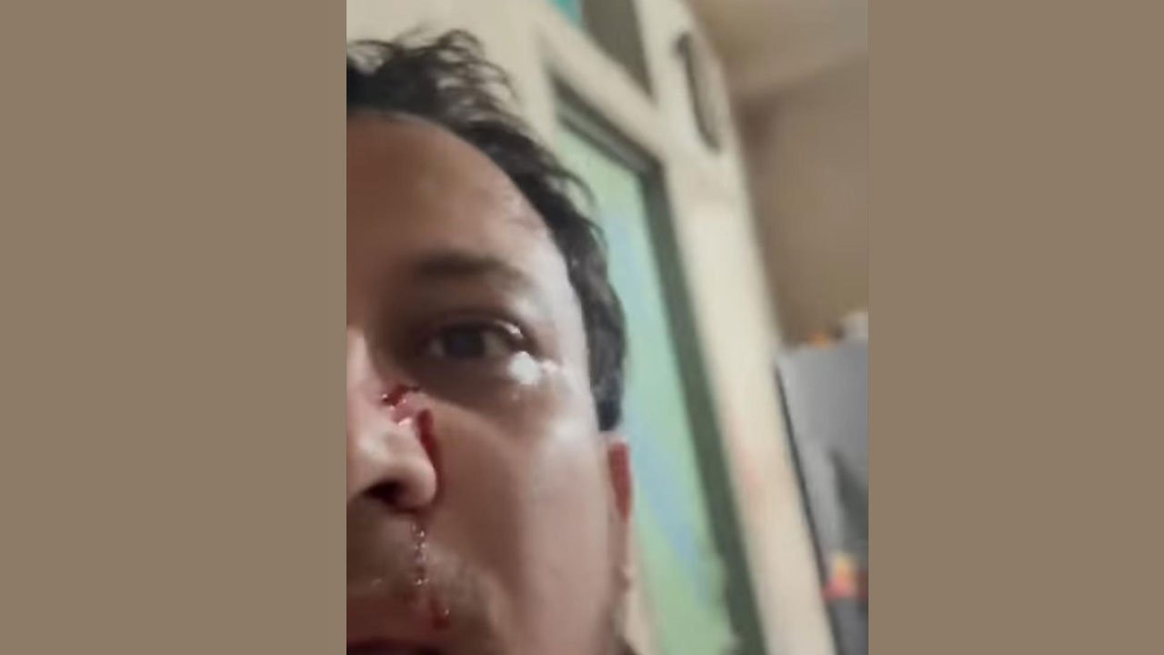 Police-rescue-doctor-after-Facebook-live-attack-in-Chittagong