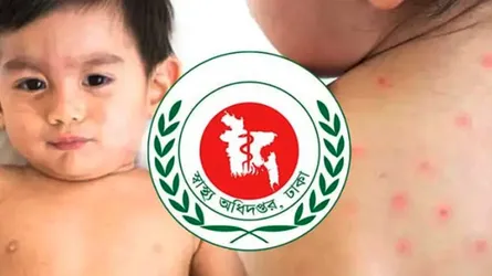 রূপগঞ্জে হামে আক্রান্ত হয়ে ৯ মাসের শিশুর মৃত্য
