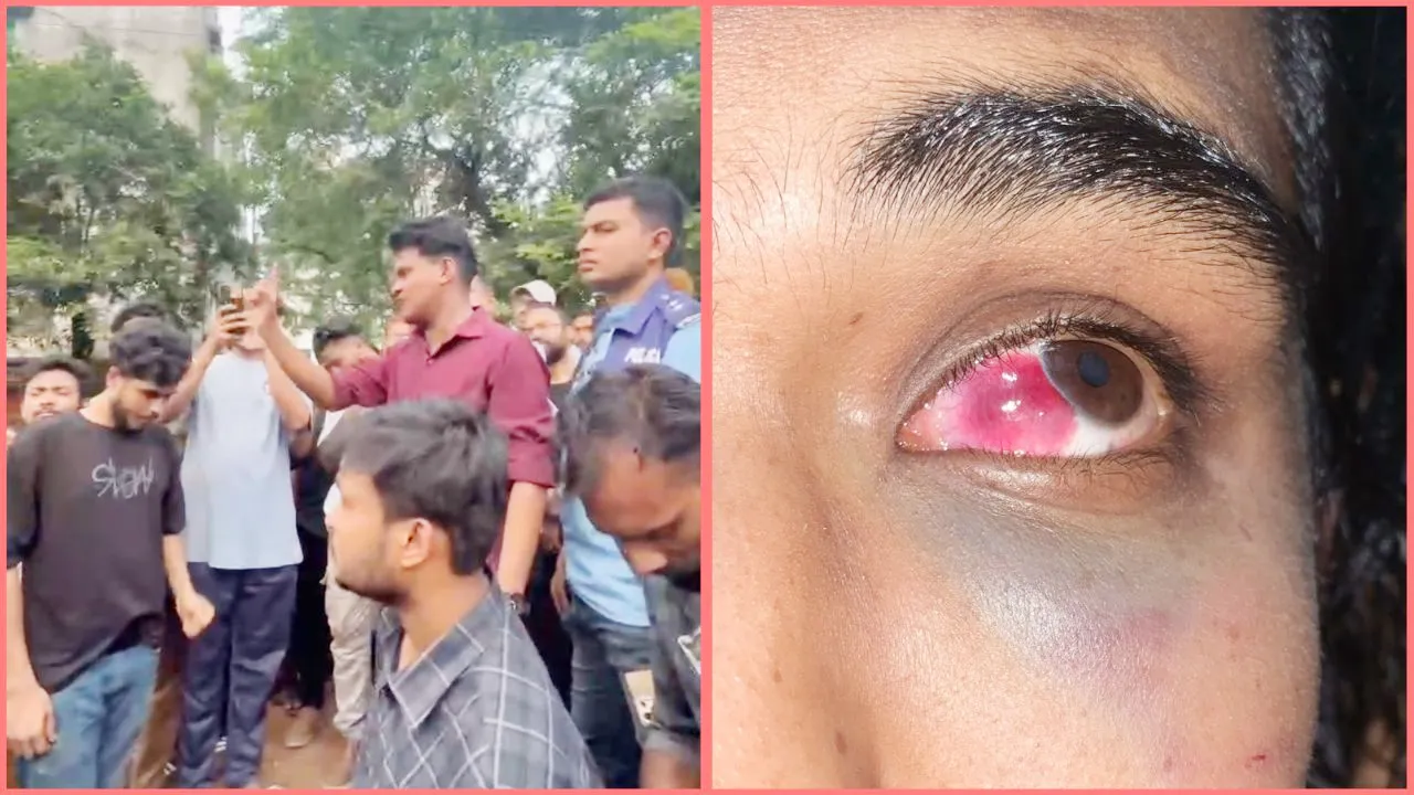 তুচ্ছ ঘটনায় সিটি ইউনিভার্সিটি ও ড্যাফোডিল ইউনিভার্সিটির শিক্ষার্থীদের মধ্যে মারামারি