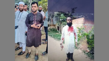 সীতাকুণ্ডে জামায়াতের সভায় সন্ত্রাসী হামলায় গুলিবিদ্ধ ২, আহত ১০