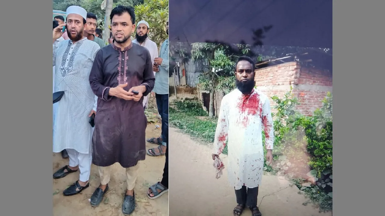 সীতাকুণ্ডে জামায়াতের সভায় সন্ত্রাসী হামলায় গুলিবিদ্ধ ২, আহত ১০