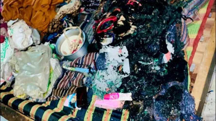 সোনারগাঁওয়ে মোবাইল চার্জার বিস্ফোরণ, দগ্ধ ৪