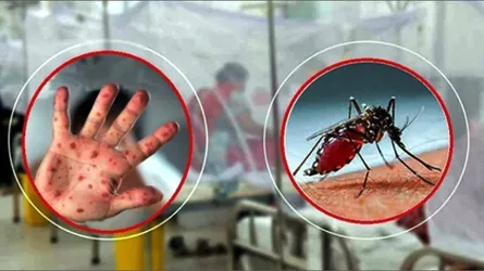 সিলেটে হামের সংক্রমণের মধ্যে উদ্বেগ ছড়াচ্ছে ডেঙ্গু