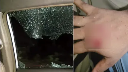 সিলেটে এনসিপির গাড়িবহরে ফের হামলা : নাসিরুদ্দীন পাটওয়ারীসহ আহত ২