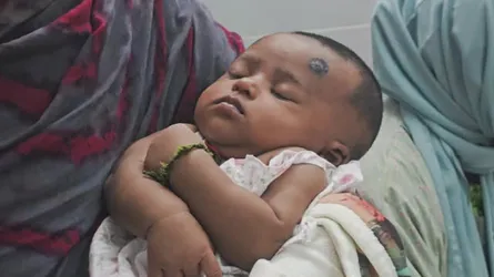 নিয়মিত টিকার পরিবর্তে ১ মাস বয়সী শিশুকে দেয়া হলো জলাতঙ্কের ভ্যাকসিন