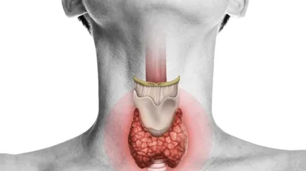 দেশের অর্ধেক মানুষ হরমোনজনিত সমস্যায় ভুগছে