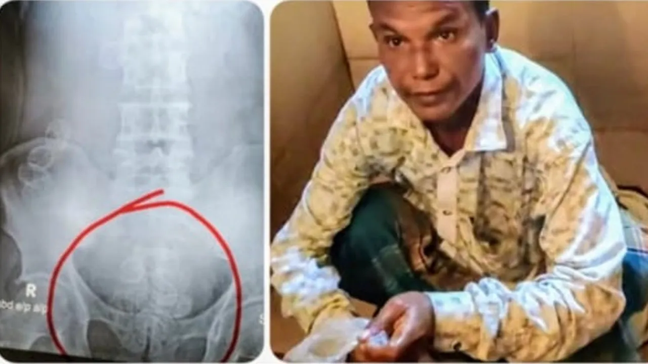 পেটের ভেতরে মিলল ৩৪ প্যাকেট ইয়াবা, নারীসহ আটক ৩
