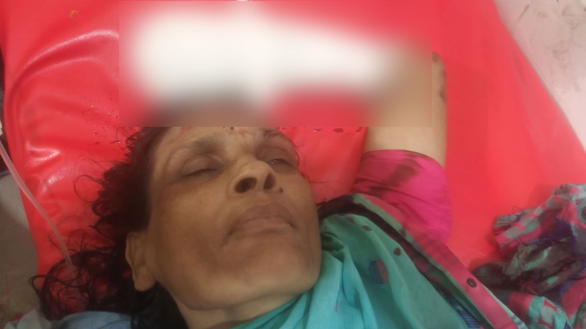 Woman's-hand-severed-by-train