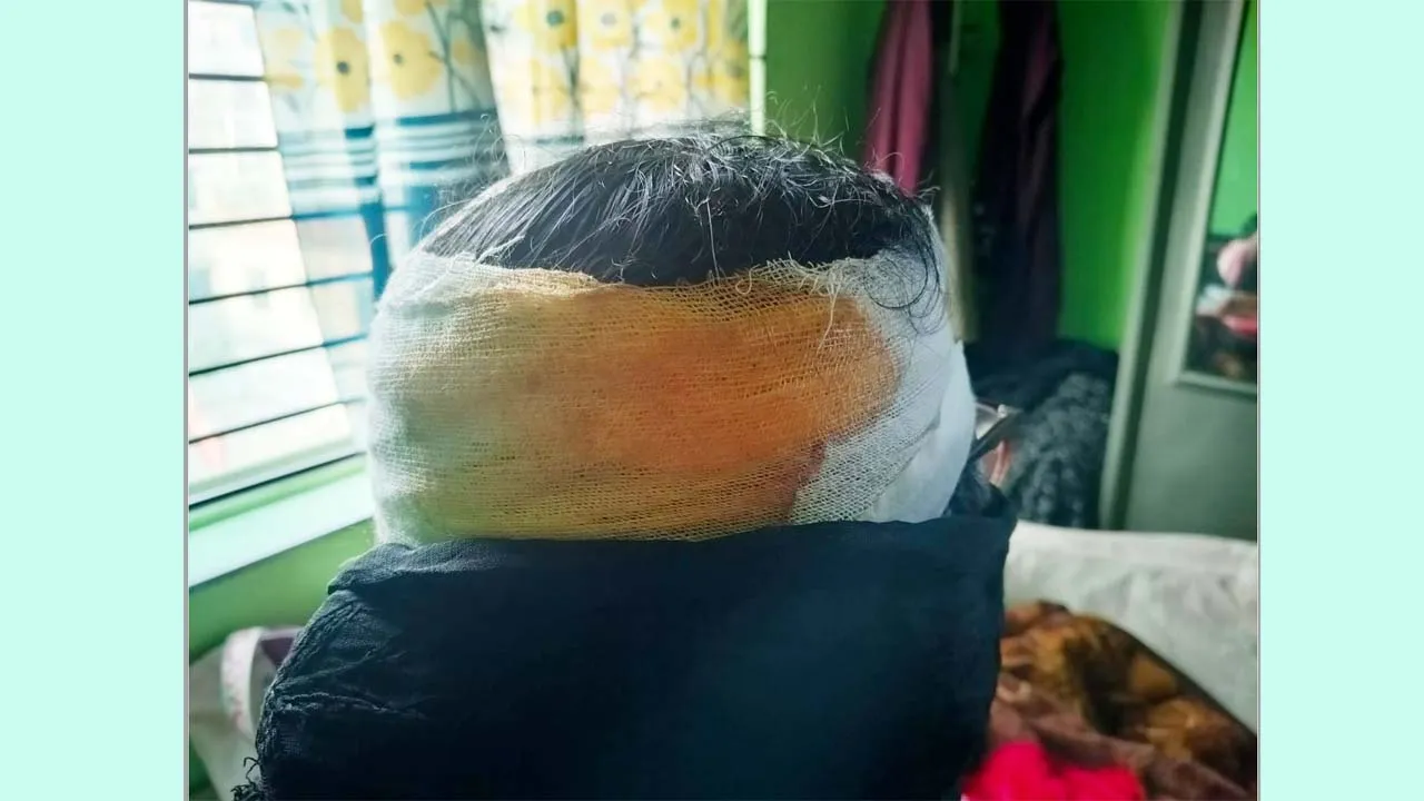রাজধানীর কদমতলীতে জামায়াত নেত্রীকে কুপিয়ে জখম