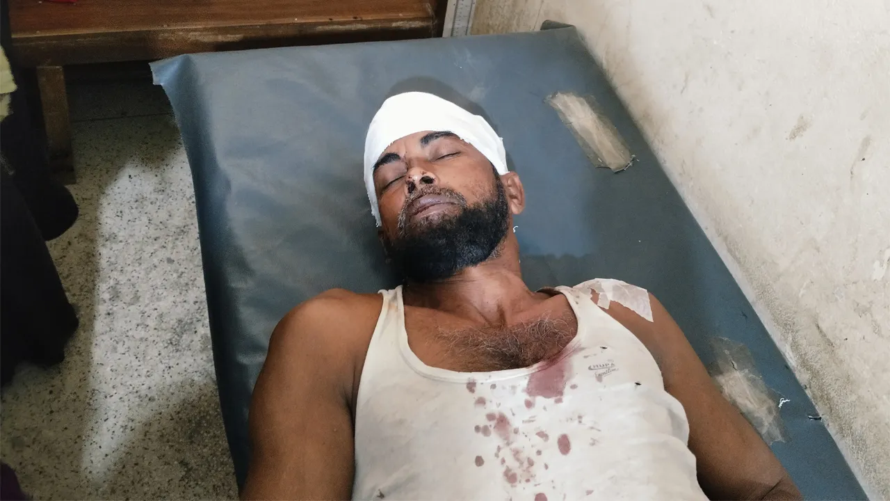 হাতিয়ায় চাঁদা না দেয়ায় ব্যবসায়ীকে কুপিয়ে গুরুতর জখম