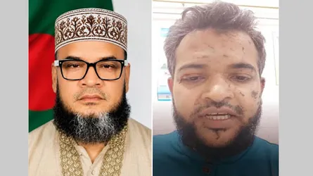 ভাণ্ডারিয়ায় জামায়াতের ২ নেতার ওপর যুবদলের হামলার অভিযোগ, শামীম সাঈদীর নিন্দা