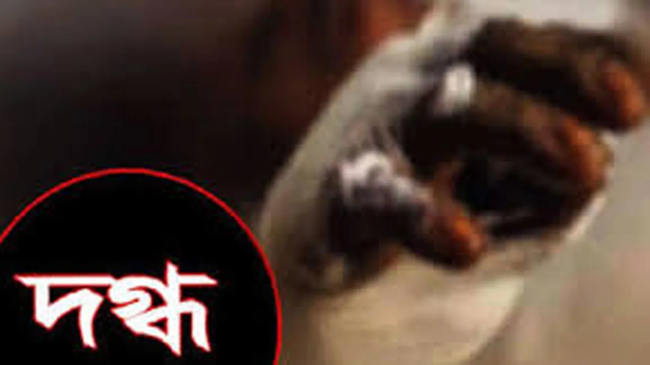 শ্রীমঙ্গলে দগ্ধ বাবা-ছেলের মৃত্যু, আশঙ্কাজনক অবস্থায় মা