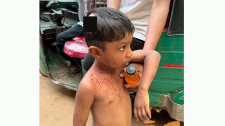 দেবিদ্বারে শত্রুতার জেরে সাড়ে ৩ বছরের শিশুকে কুপিয়েছে প্রতিপক্ষ