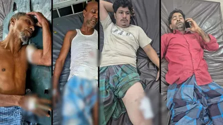 রাউজানে সভা শেষে বাড়ি ফেরার পথে গুলিতে আহত ৫