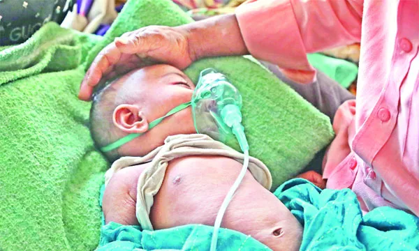 হাম উপসর্গ নিয়ে হাসপাতালে ভর্তি থামছে না : ১ শিশুর মৃত্যু