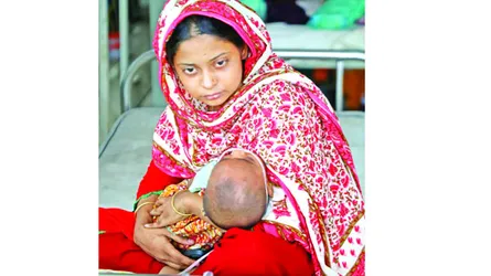 ২০২১ থেকেই বাড়ছিল হাম, ব্যবস্থা না নেয়ায় বর্তমানের মহামারী