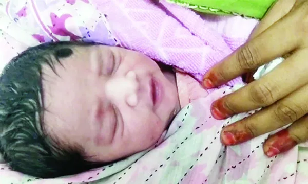 হামের প্রাদুর্ভাব মোকাবেলায় ‘জরুরি  টিকাদান’ কর্মসূচি শুরু কাল