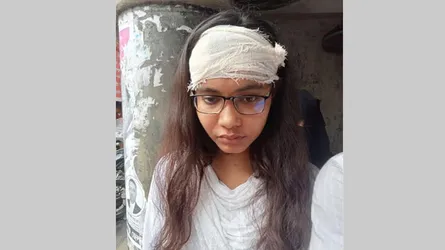 এজলাসে শিক্ষানবিশ আইনজীবীকে পেপার ওয়েট ছুড়ে মারলেন বিচারক, হাসপাতালে ভর্তি