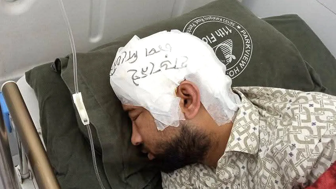 ‘হাড় নেই, চাপ দিবেন না’