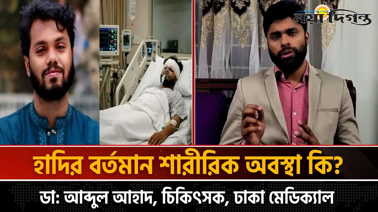 হাদিকে সিঙ্গাপুর থেকে যুক্তরাষ্ট্র নেয়ার ব্যাপারে যা জানালেন ডাঃ আহাদ