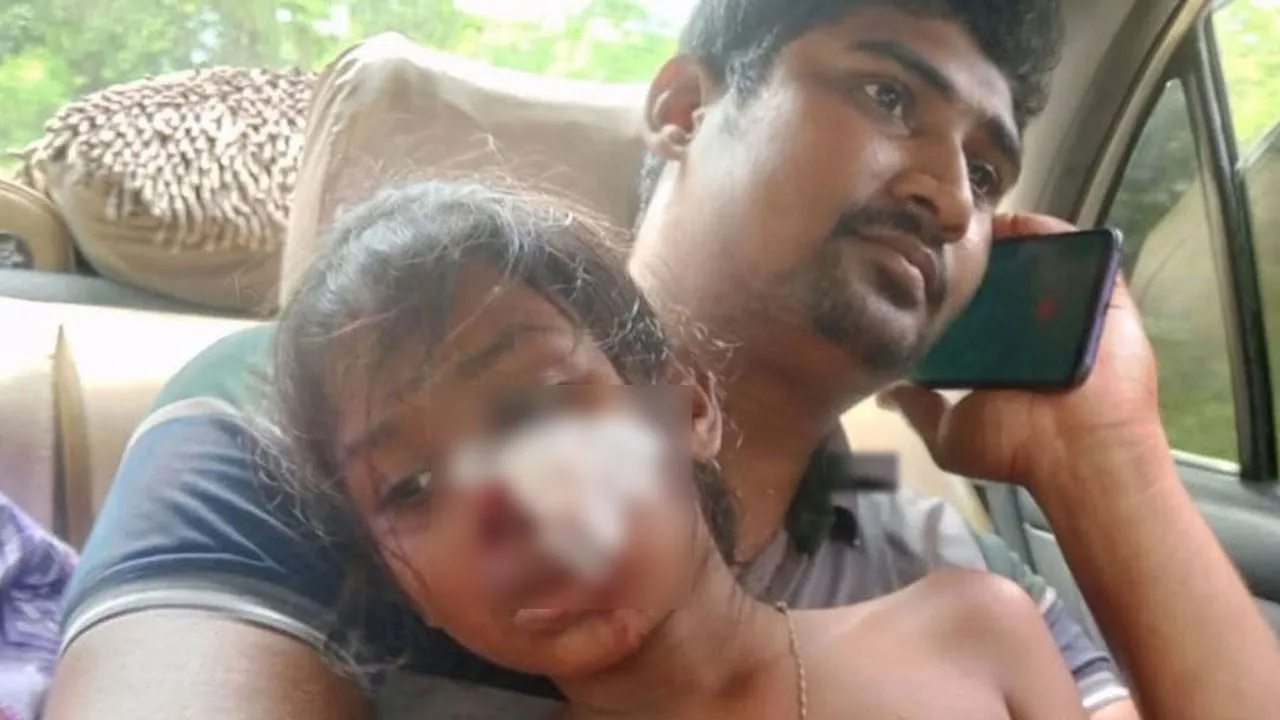 পাইকগাছায় ঝুলন্ত ফ্যান ছিঁড়ে শিক্ষার্থী আহত