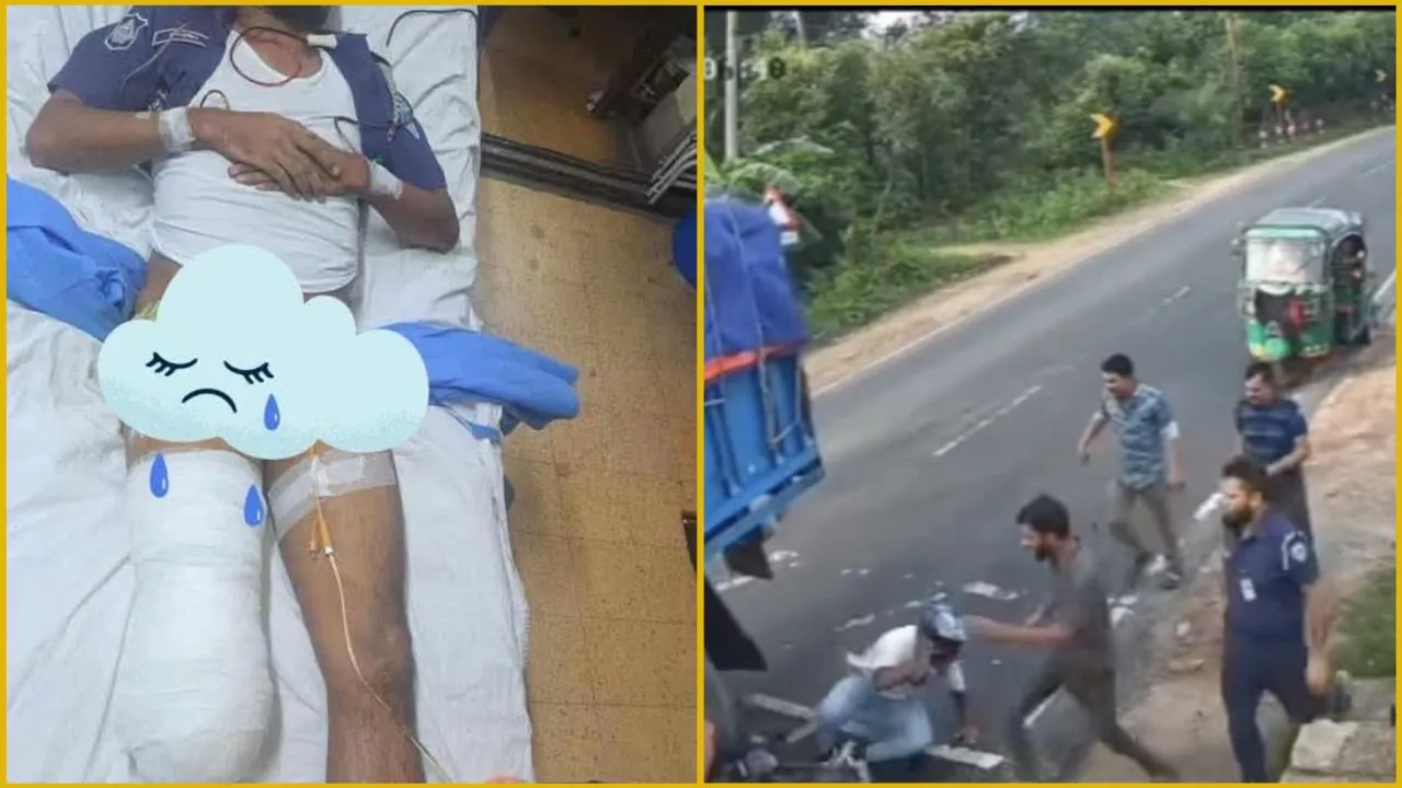 লোহাগাড়ায় মোটরসাইকেল আরোহীকে পুলিশের ধাক্কা, পা হারালেন আরেক সদস্য