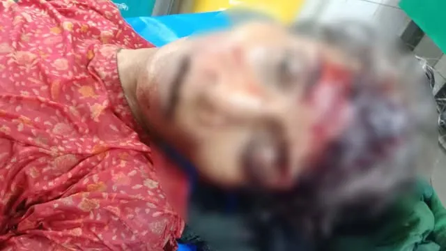 রাজনগরে সিএনজিচালিত অটোরিকশার ধাক্কায় বৃদ্ধা নিহত