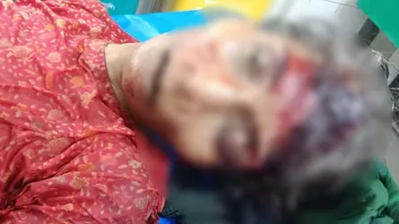 রাজনগরে সিএনজিচালিত অটোরিকশার ধাক্কায় বৃদ্ধা নিহত
