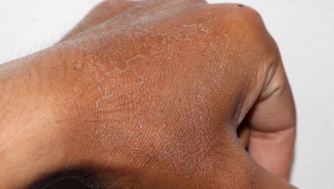 skin