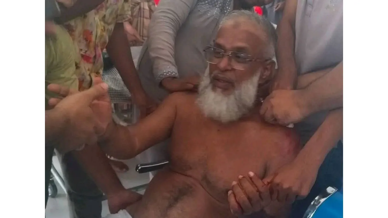 চরফ্যাশনে থানা বিএনপির সভাপতিকে কুপিয়ে আহত