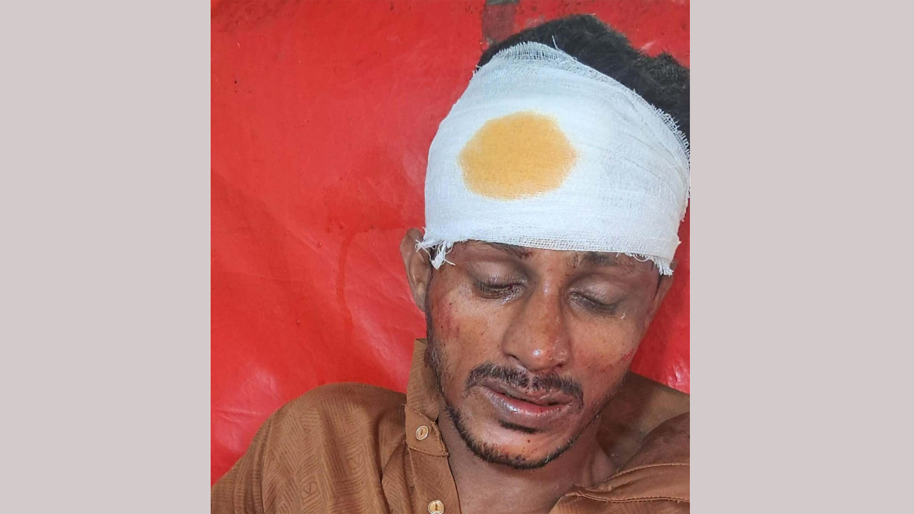 প্রতিপক্ষের হামলায় গুরুতর আহত যুবদলকর্মী সুমন। বুধবার দুপুরে সোনাগাজী উপজেলা স্বাস্থ্য কমপ্লেক্স থেকে তোলা ছবি