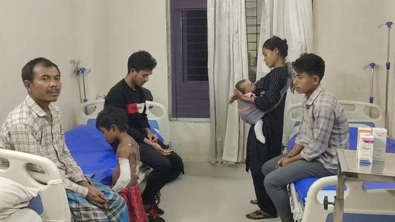 বান্দরবানে অসহায় পরিবারের অগ্নিদগ্ধ দুই শিশুকে সামরিক হাসপাতালে চিকিৎসা দেয়া হচ্ছে