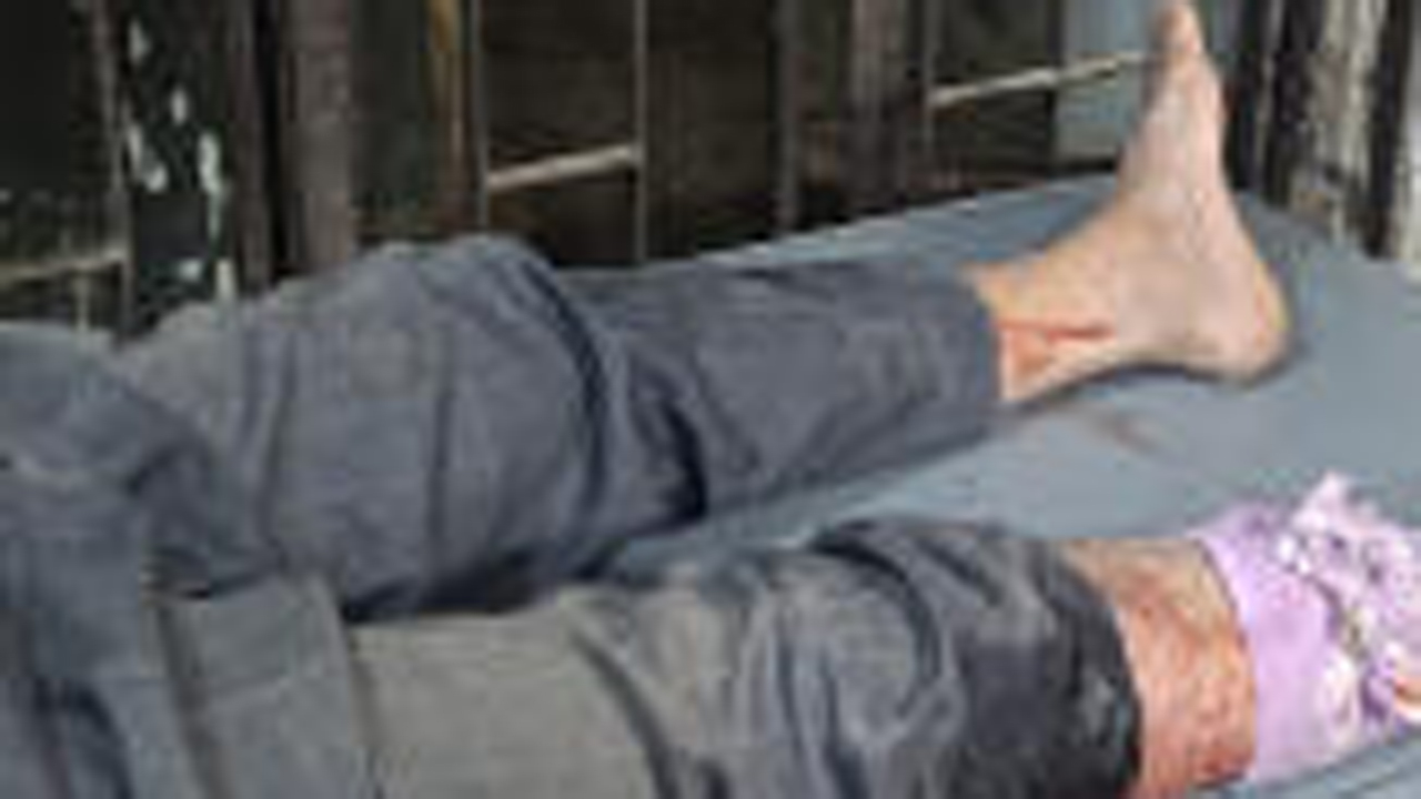 আহত বনকর্মকর্তা