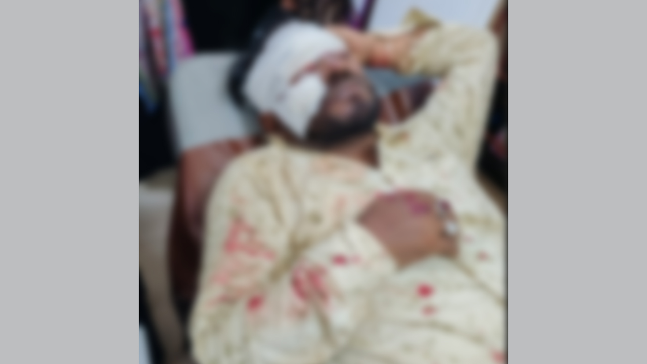 হামলায় আহত মো: আবু বক্কর