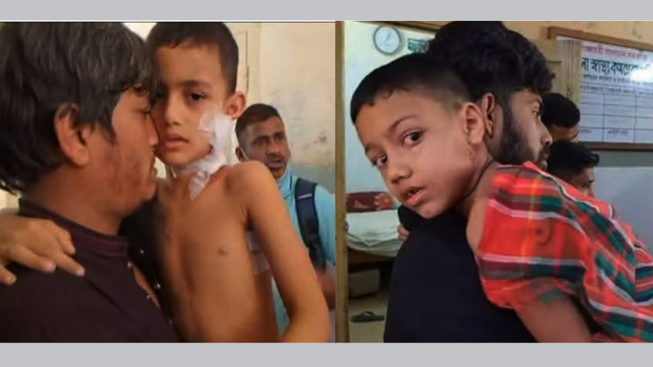 দে‌বিদ্বা‌রে পাগলা কুকুরের কাম‌ড়ে ৫ শিশু আহত
