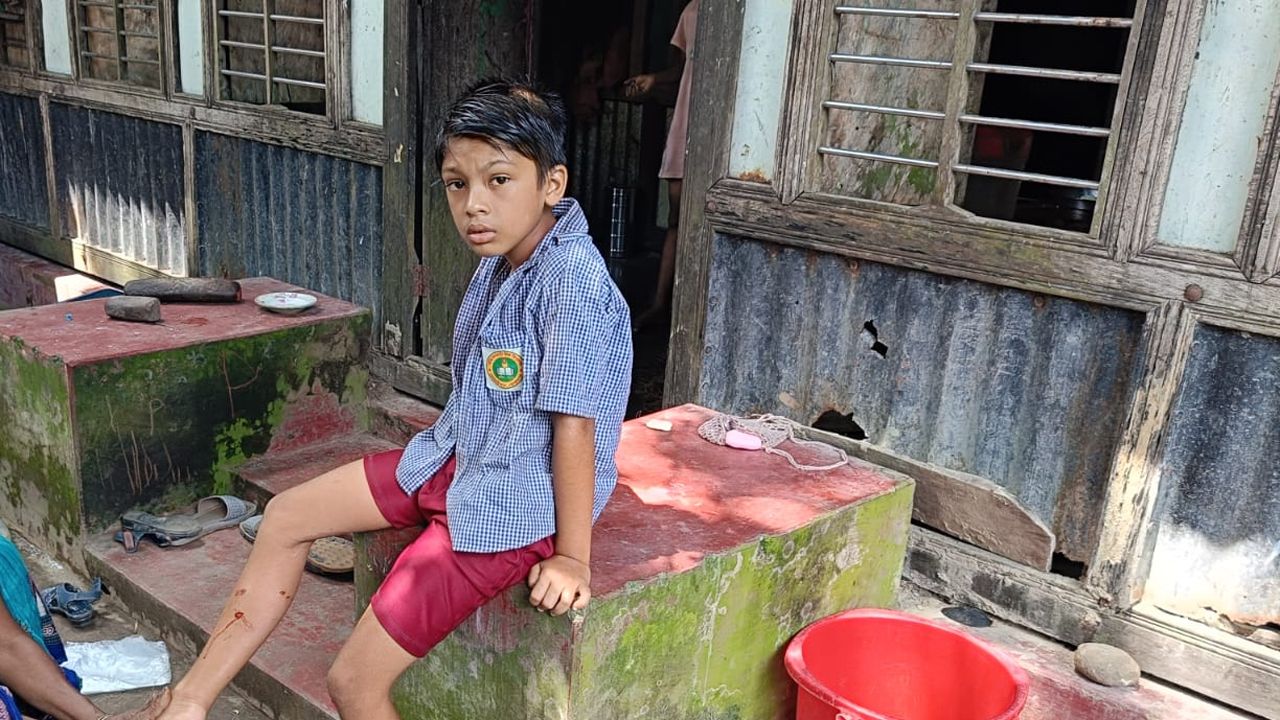 কুকুরের কামড়ে আহত এক শিক্ষার্থী